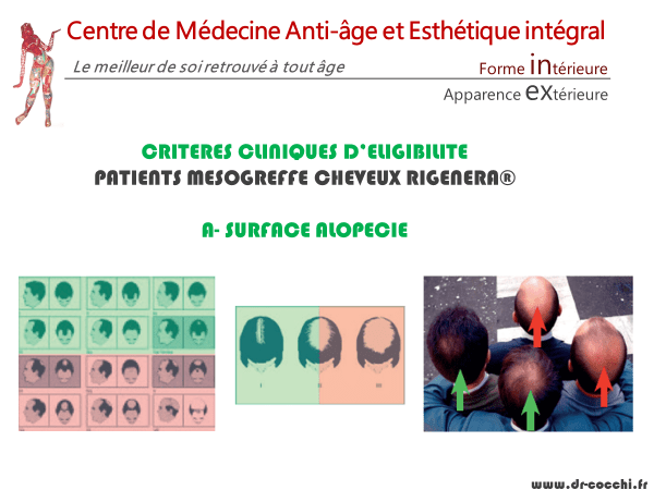 Critères d'éligibilité surface alopécie